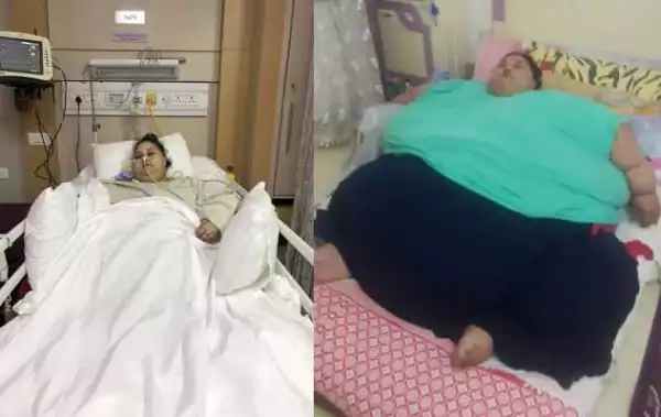 World Heaviest Woman Turns Half Her Former Size After Life-Saving Surgery (Photos)